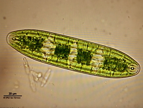 Zieralge Netrium interruptum